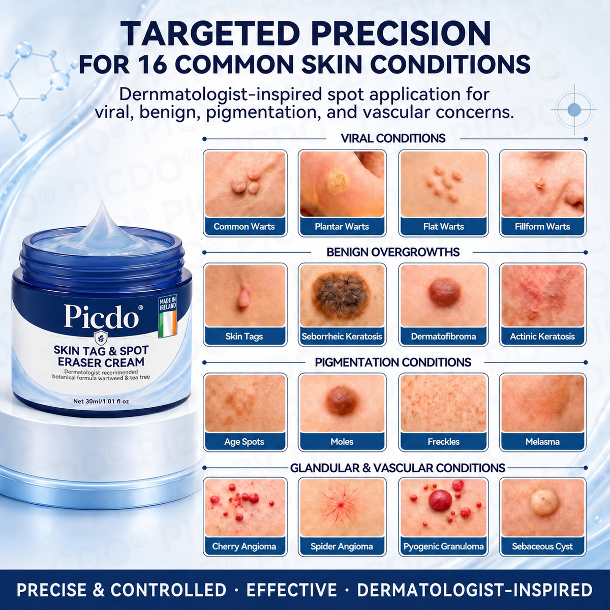 ✨✨𝐏𝐢𝐜𝐝𝐨® 7-𝐃𝐚𝐲 𝐒𝐤𝐢𝐧 𝐓𝐚𝐠 & 𝐒𝐩𝐨𝐭 𝐄𝐫𝐚𝐬𝐞𝐫 𝐂𝐫𝐞𝐚𝐦🩵 (Zero Pain, Zero 𝐒𝐜𝐚𝐫𝐬 Formula) 💪